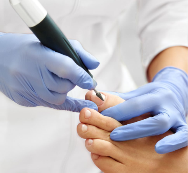 Sessão de podologia com profissional usando luvas azuis e instrumento especializado